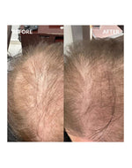 Onovo Daily SuperHair * 60