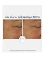 Neostrata Potent Retinol Complex Cream * 30 ML