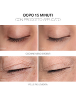 Rvb Lab Meso Fill Concealer Fill&correct Smoothing Treatment Corrector