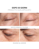 Rvb Lab Meso Fill Concealer Fill&correct Smoothing Treatment Corrector