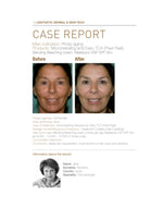 Skintech Blending Bleaching Cream 50 ML