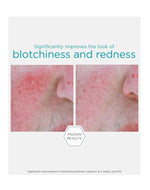 Neostrata Restore Redness Neutralizing Serum